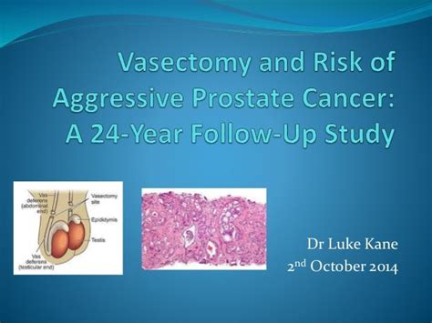 Detect Your Risk of Aggressive Prostate Cancer.